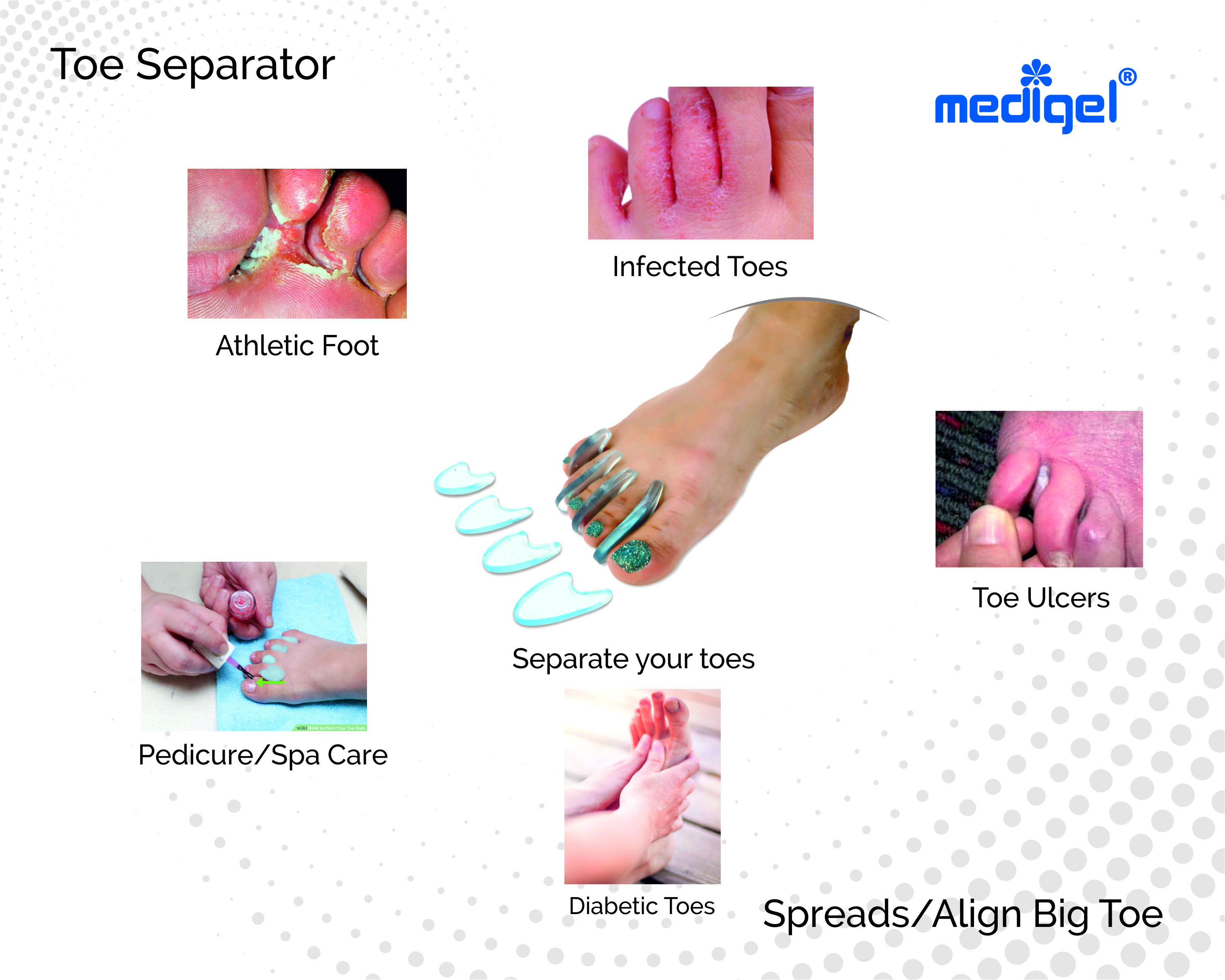 Medigel® Toe Separator (4 pc set)  Standard